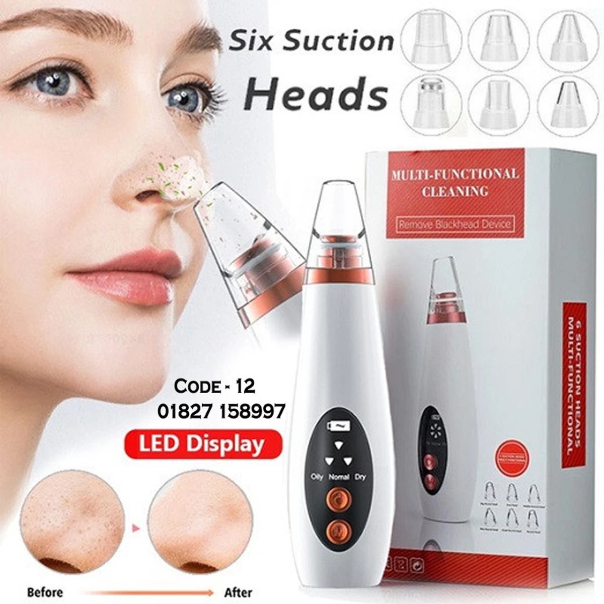 Rechargeable Blackhead Remover Vacuum Pore Cleaner 6 Suction Heads