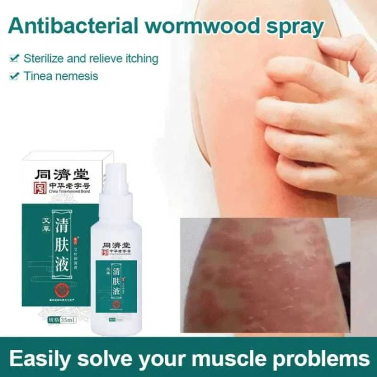 New Antibacterial Spray - এলার্জি/চুলকানি/সোরিয়াসিস সহ চর্মরোগ প্রতিরোধী
