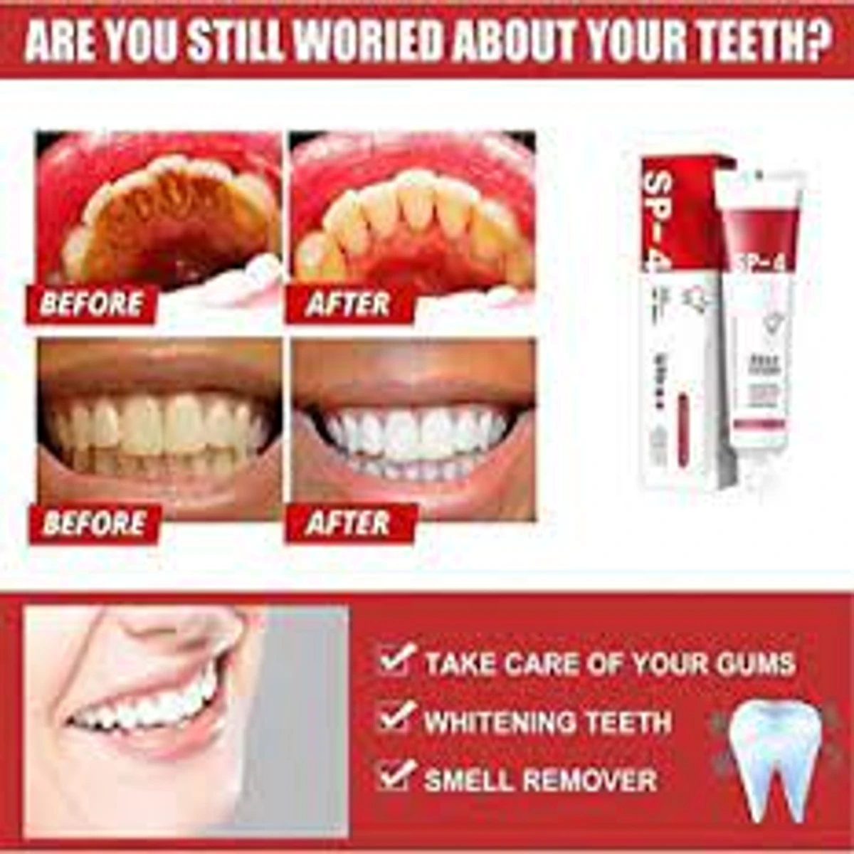 SP-4™ Probiotic Whitening Toothpaste (100 GM)
